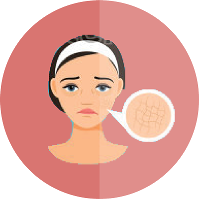 Dry Skin
